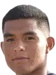 Luiggi Alburqueque