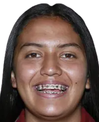 Brenda Vega